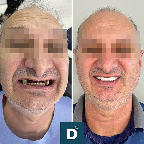 Dentiavita | Dentista in Albania