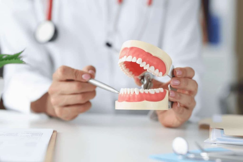 piorrea dopo quanto cadono i denti